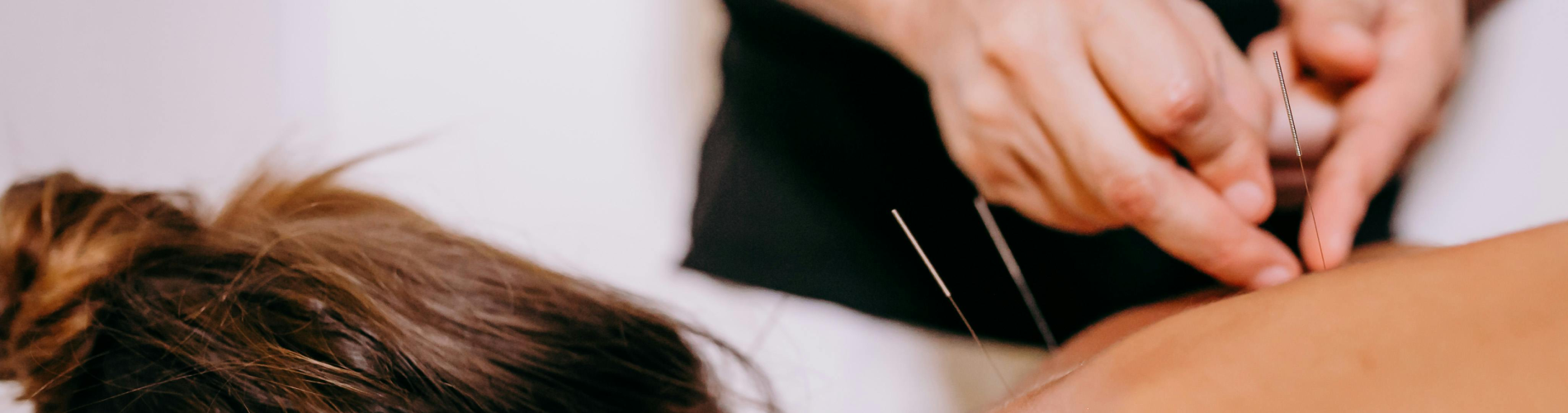 acupunctuur behandeling Deventer
