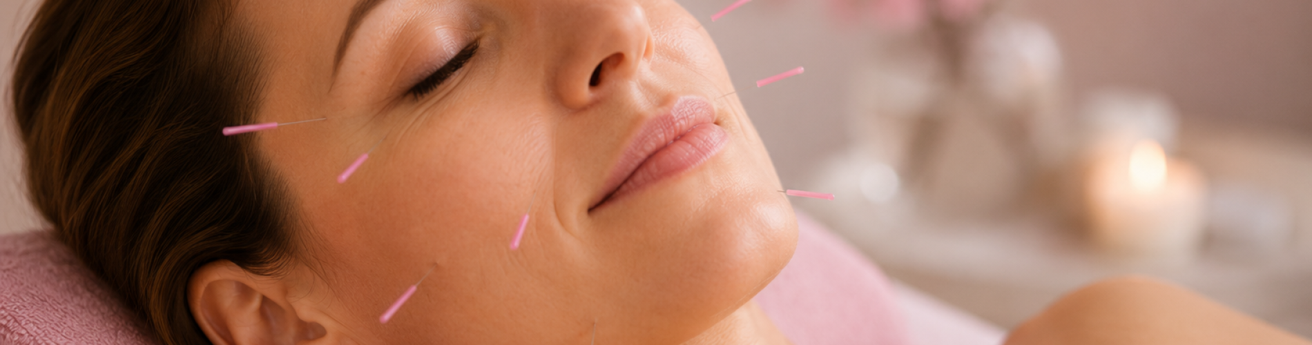 cosmetisch acupunctuur